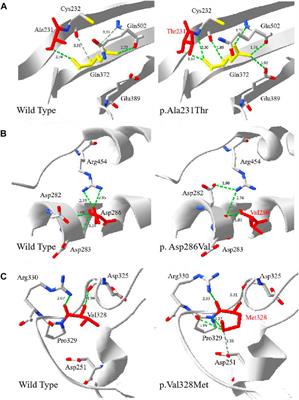 Molecular heterogeneity of glucose-6-phosphate dehydrogenase deficiency in neonates in Wuhan: Description of four novel variants